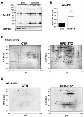 Pyruvate kinase M2 modification by a lipid peroxidation byproduct acrolein contributes to kidney fibrosis